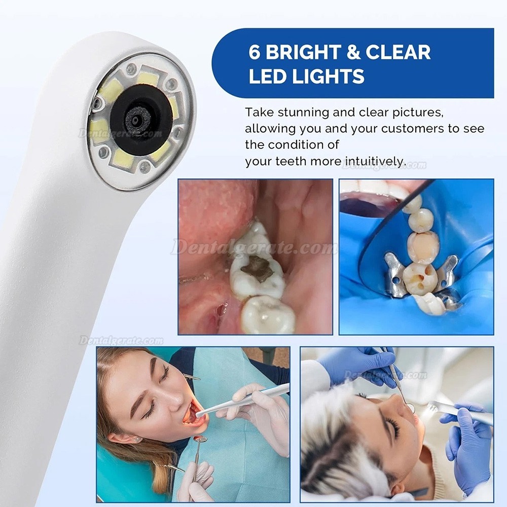 Magenta MD280 720P HD USB Dentale Intraoralkamera f&uuml;r Win 10/11